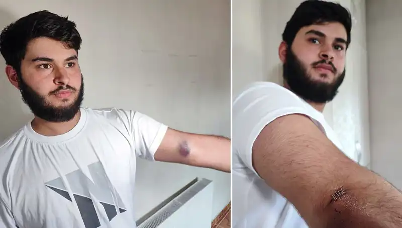 Bahçeye Kaçan Top, Mahallede Eğlenceli Kargaşa Yarattı